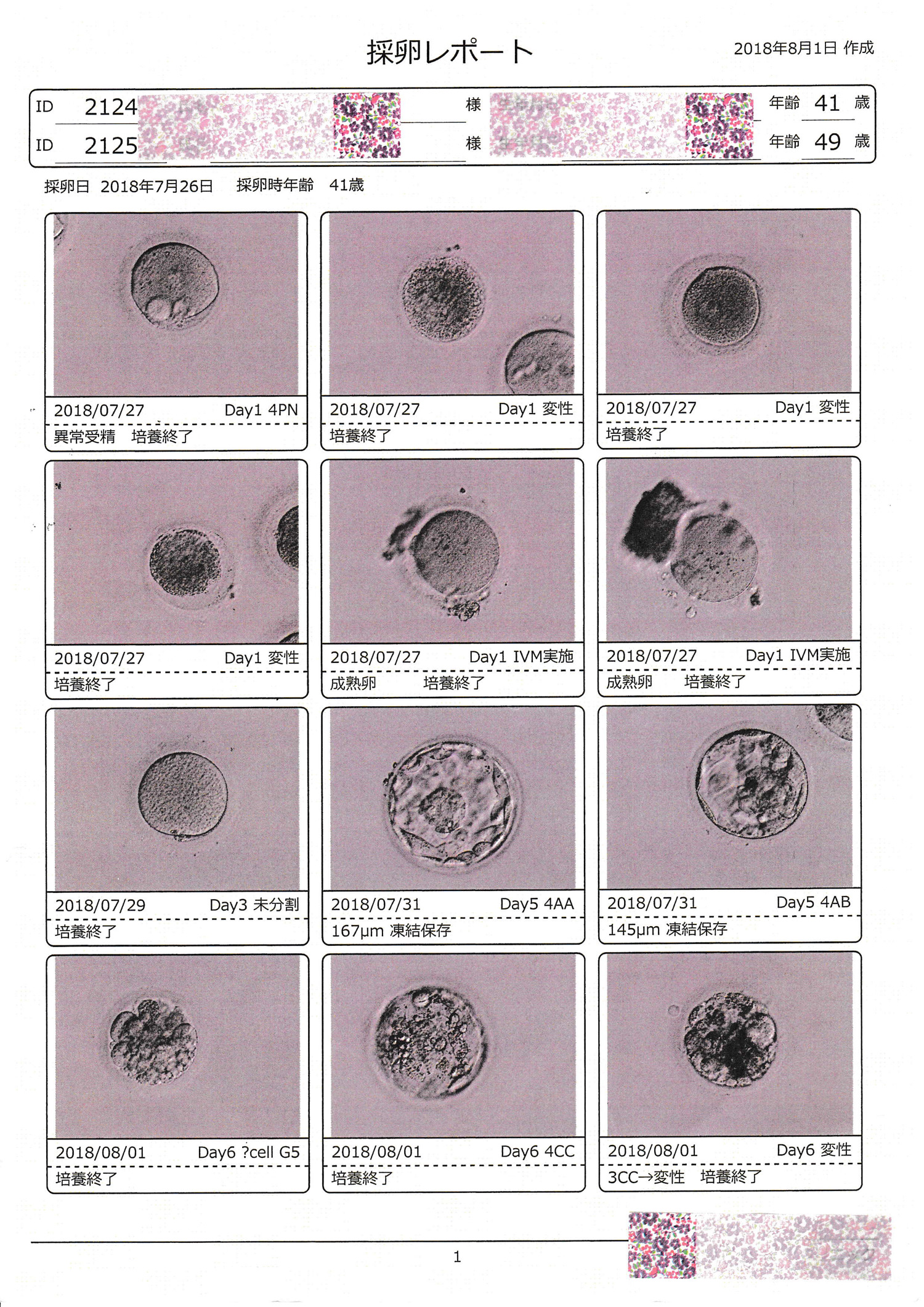 採卵レポート1-1