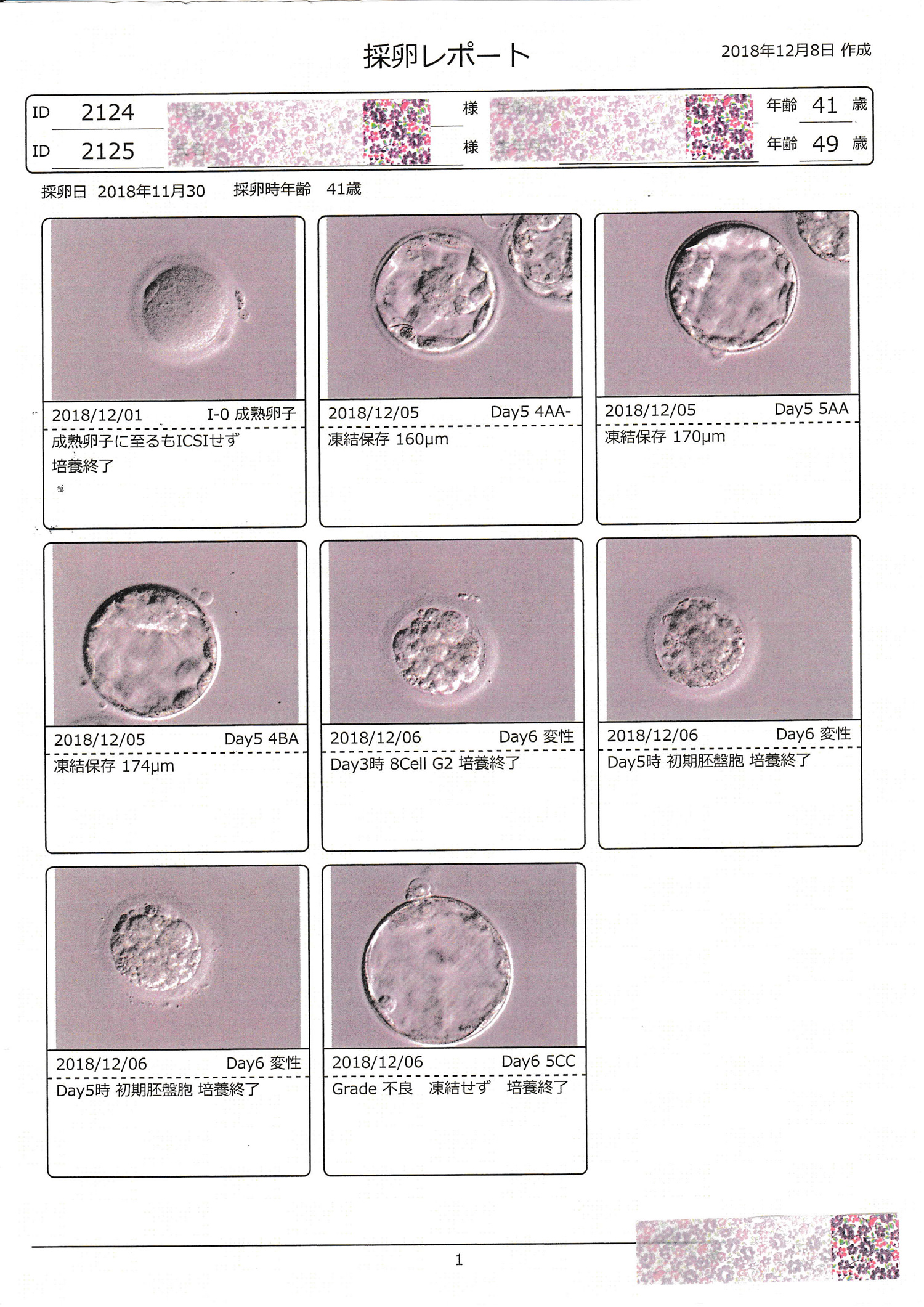 採卵レポート1-3